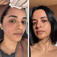 I Tried the Celebrity-Loved Salmon Sperm Facial — Here's My Honest Take
